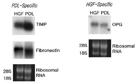 Northern Blot Analysis Of Gene Expression Of PDL Cells And HGFs To