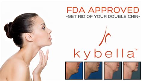 Kybella Dermatology Care Of Charlotte