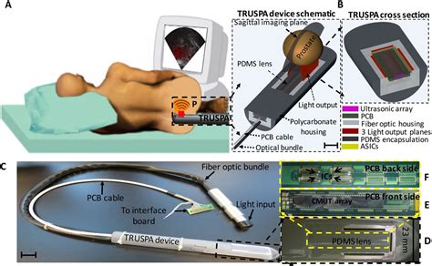 Prostate Anatomy Ultrasound