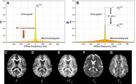 Primary Multiparametric Quantitative Brain MRI State Of The Art