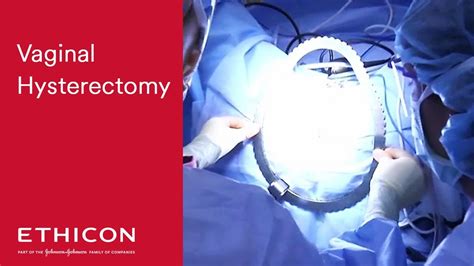 Use Of Surgical Innovations To Facilitate The Difficult Vaginal My XXX Hot Girl