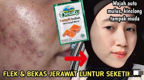 3 Cara Bikin Wajah Putih Glowing Dengan Kunyit Cuma Pakai Bahan Dapur