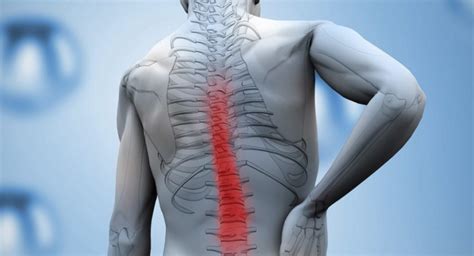 Physiotherapy Rehabilitation for Spinal Cord Injury and Its Benefits ...