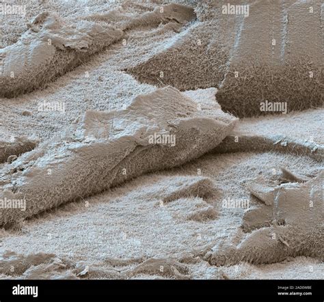 La Cartilagine Color Scanning Electron Microfotografia Di Una Sezione