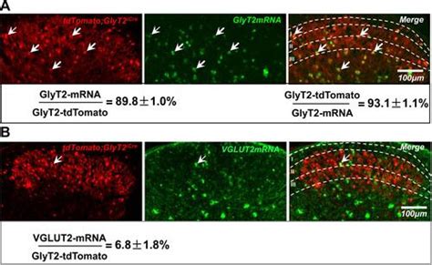 Full Article Molecular And Electrophysiological Characterization Of