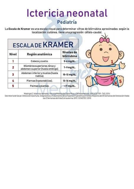 Evaluación Ictericia neonatal David William uDocz