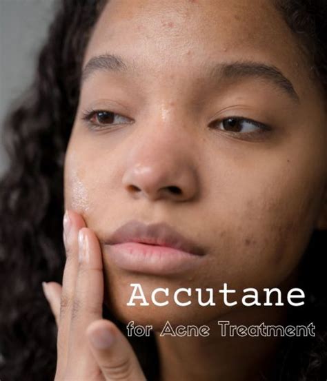 Accutane For Acne Treatment Dr Kally Papantoniou