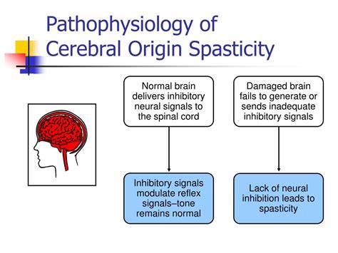 Ppt Intrathecal Baclofen For Spasticity Powerpoint Presentation Free Download Id 1245439