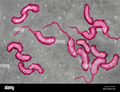 Vibrio Cholerae Microscope