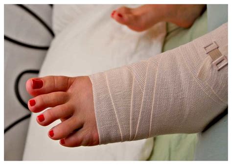 How To Wrap A Sprained Ankle Method Steps Care Atelier Yuwa Ciao Jp