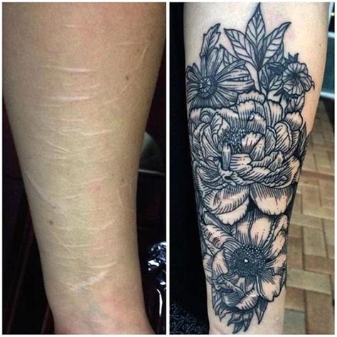 Tatuajes para Tapar Cicatrices Diseños Bonitos y Originales Tatuajes