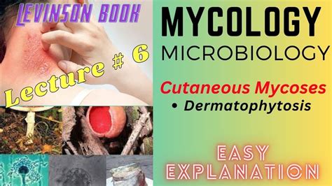 Mycology Microbiology Cutaneous Mycoses Dermatophytosis Lecture