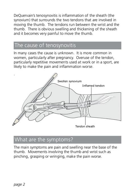 De Quervains Tenosynovitis Anatomy