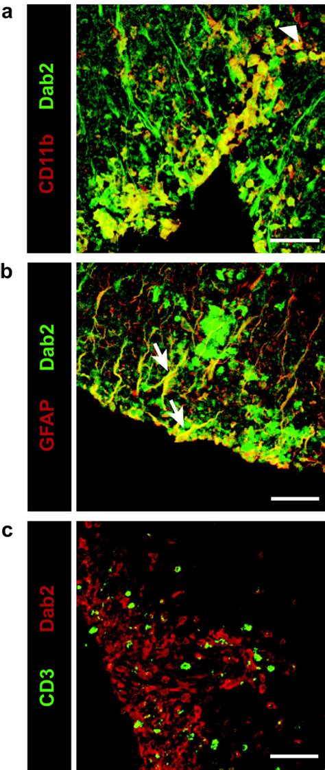 Characterization Of Dab Expression Within The Eae Spinal Cord