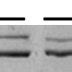 Electrophoretic Separation Of Myosin Heavy Chain MHC Isoforms From