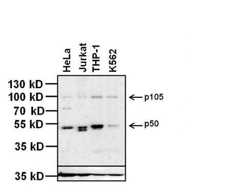 Anti-NFKB1 / NF-Kappa-B Antibody | Mouse anti-Human Monoclonal | LSBio 
