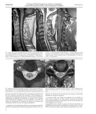 Techniques D Tude Dirm Et Anatomie Normale Du Rachis Cervi Pdf