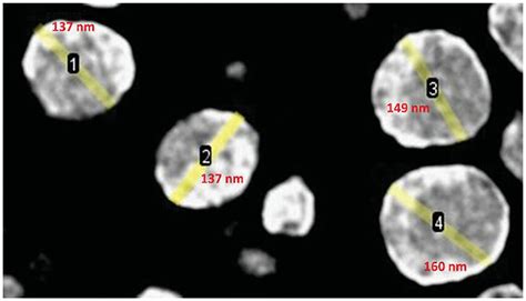 Transmission Electron Microphotograph Of Optimized IBU NLC In Spherical