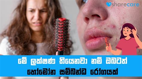 Signs Of Hormonal Imbalance Causing Skin Problems මේ ලක්ෂණ තියෙනවා