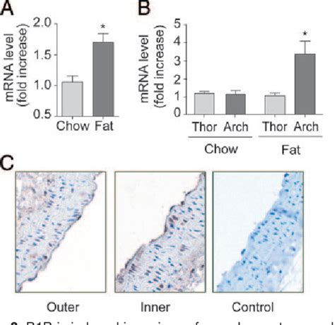 Figure 2 From Laminar Shear Stress Regulates Endothelial Kinin B1