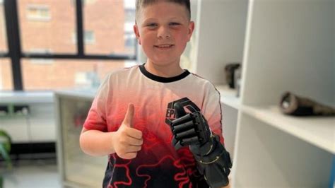 New Bionic Arm Absolutely Life Changing For Boy From Bude BBC News