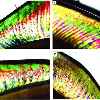 Scanning electron micrographs of normal enamel specimen and section B ...