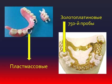 Кламмерная система в стоматологии - презентация онлайн