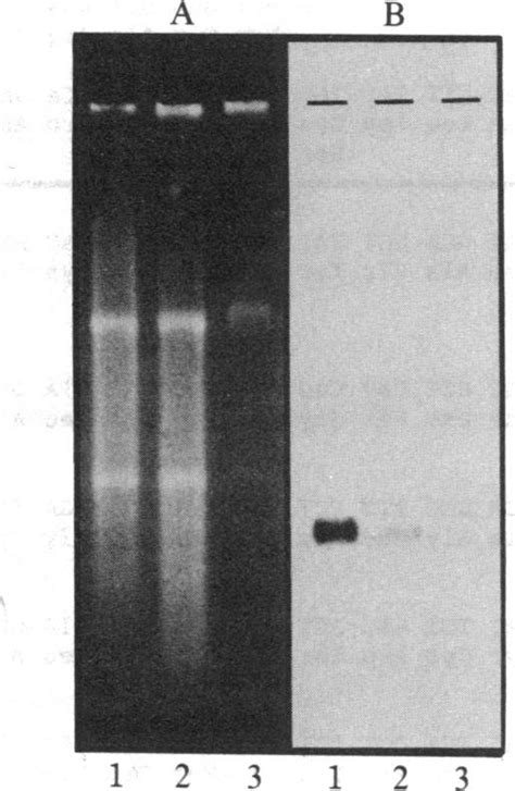 Rna Transfer Hybridization Of 32p Labeled A Gal A Cdna With Hela