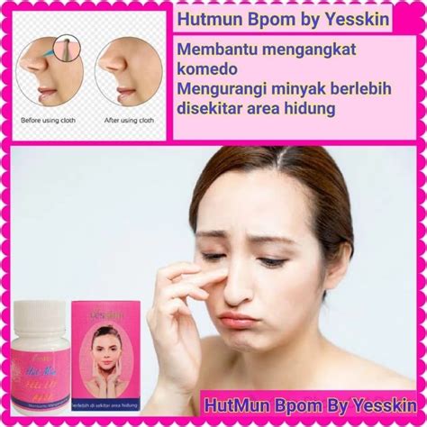 Jual HUT MUN GEL KOMEDO HUTMUN GEL KOMEDO HIDUNG Shopee Indonesia