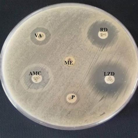 A Represented Creamcolored Colonies Of S Aureus On Staph Medium