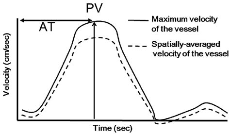 The Definitions Of Acceleration Time At And Peak Velocity Pv Download Scientific Diagram