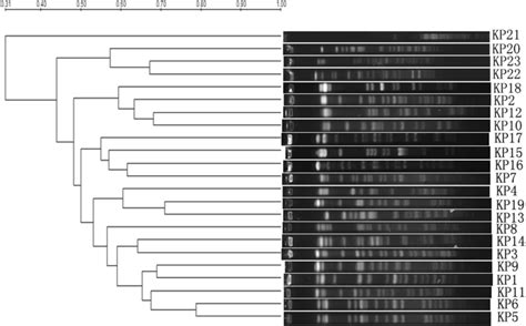 Pulsed Field Gel Electrophoresis Of XbaI Digested Genomic DNA From The