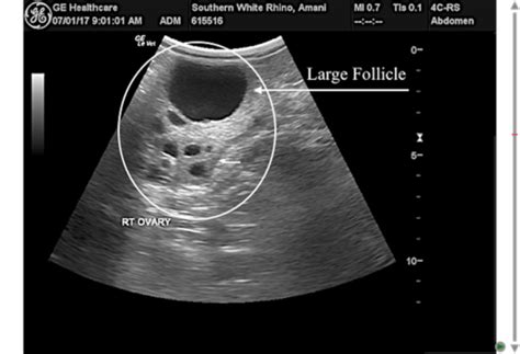 Lesson Gynecology Physiology Flashcards Quizlet