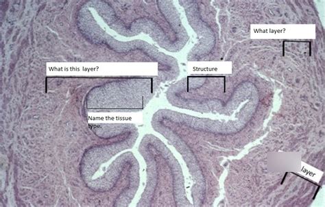 Ureter Slide Diagram Quizlet