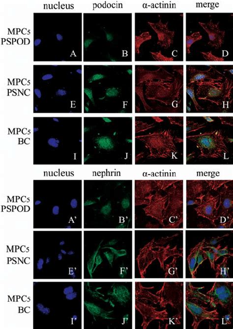 Immunofluorescence Double Staining For Podocin And A Actinin And