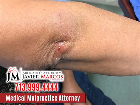 Attorney Javier Marcos Is An Experienced Medical Malpractice Lawyer