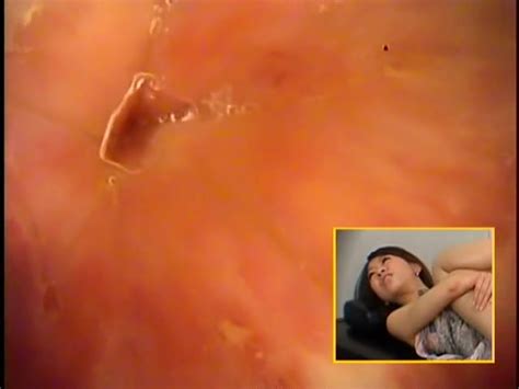 Japanese girl anal endoscope video ThisVid 日本語で
