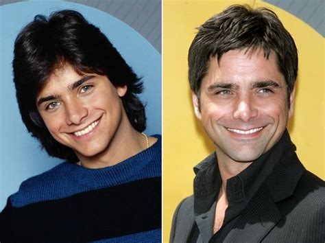 John Stamos Face Plastic Surgery Rumor Of Truth