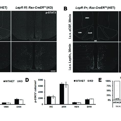 Leptin Induced Stat3 Phosphorylation In The Hypothalamus Of Control Download Scientific