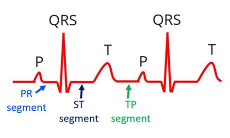 ECG Waveform Explained EKG Labeled Diagrams And Components 42 OFF