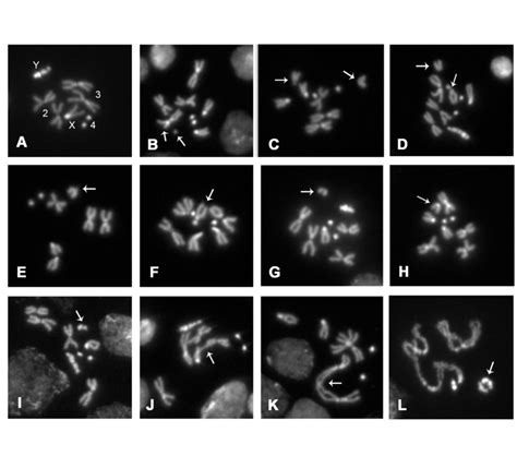 Examples Of Chromosome Aberrations Observed In Colchicine Treated Download Scientific Diagram