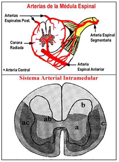 Arteria Espinal Anterior