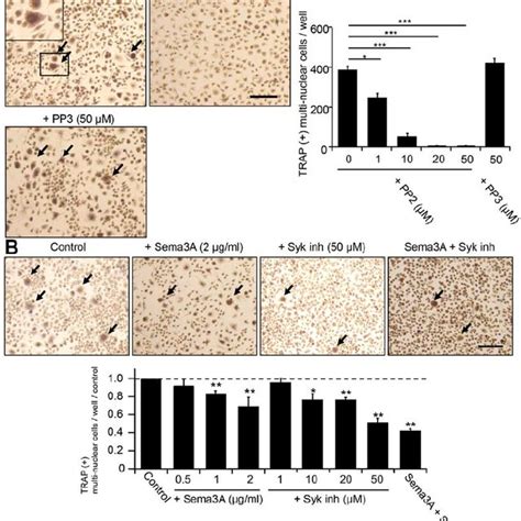 Effects Of Non Receptor Tyrosine Kinase Inhibitors And Semaphorin A On