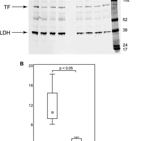 Western Blot Validation Of Differentially Expressed Protein Ldh Eight Download Scientific