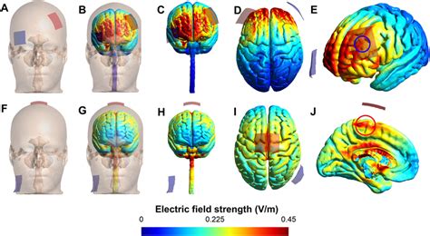 TDCS Induced Electric Field On Brain Areas For The Study Montages