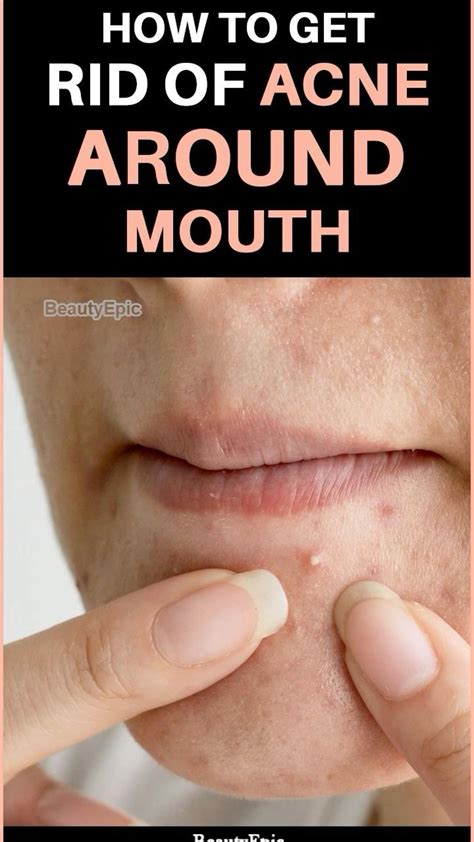 21 home remedies to get rid of rashes on the face diet and prevention ...