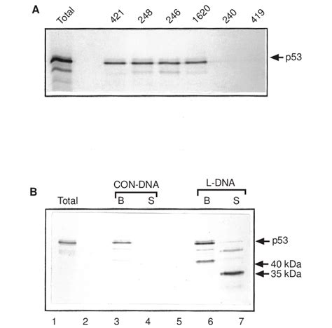 A Immunoprecipitation Of Wild Type In Vitro Translated Murine P53