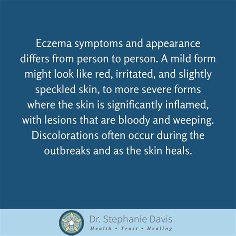 Eczema symptoms and appearance differs from person to person. A mild ...