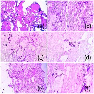 Photomicrographs of H&E stained sections showing characteristic ... 