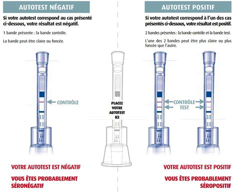 Lautotest Vih Le Nouvel Outil De Dépistage Du Sida Unooc Le Plus